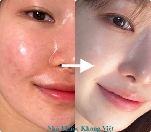 ưu Và Nhược điểm Của Serum Midik8