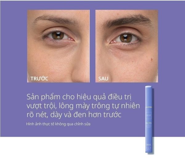 Tinh Chất Dưỡng Dày Lông Mày Obagi Eyebrow Boosting – Giúp Lông Mày Dày, Đậm Và Tự Nhiên